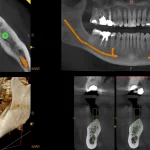 2_82003d_12x10_implant-planning_2_mar_hires