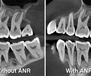 Carestream CS 8200 3D CBCT - Slika 4