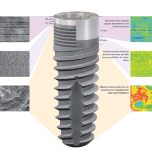 Bredent implant sistem BLUE SKY - Slika 7