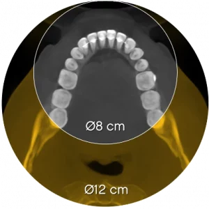 Carestream CS 8200 3D CBCT - Slika 9