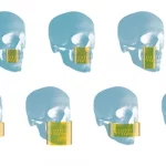 fields-of-view-teaser