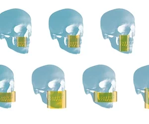 Carestream CS 8200 3D CBCT - Slika 8