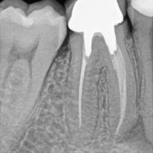 RVG Carestream CS 5200 size 1 - Slika 4