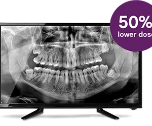 Carestream CS 8200 3D CBCT - Slika 7