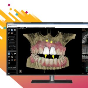 Carestream CS 8200 3D CBCT - Slika 6