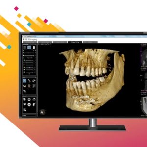 Carestream CS 8200 3D CBCT - Slika 5