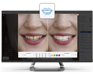 Medit i700 - intraoralni 3D skener - Slika 5