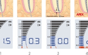 NSK iPEX II - Slika 3