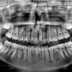 10_9600_pano_tomosharp